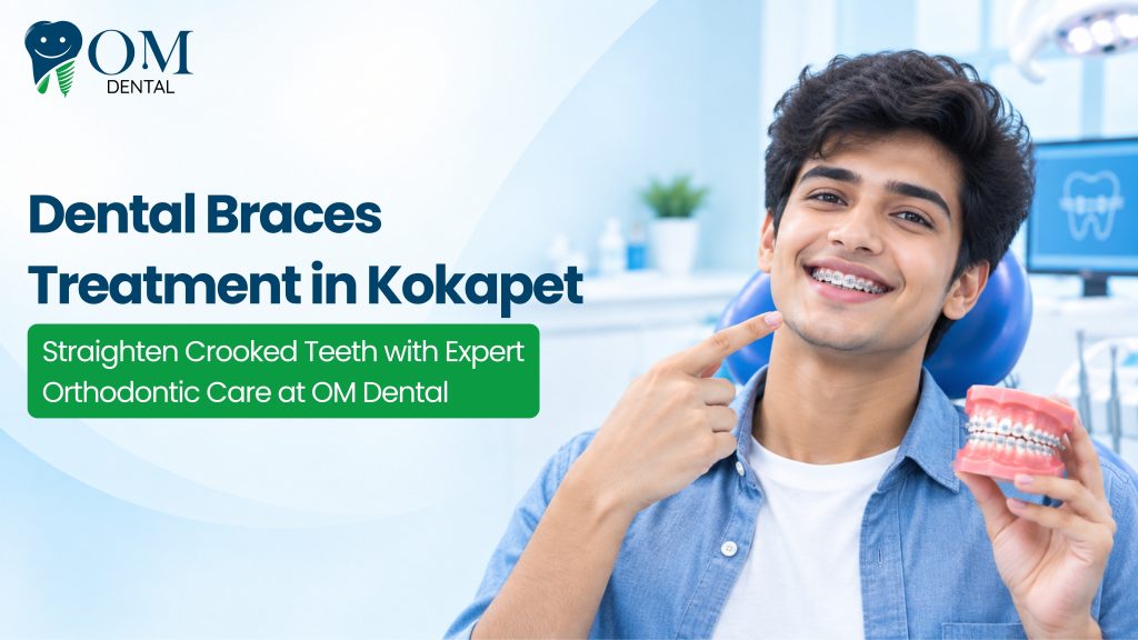 Dental Braces Treatment in Kokapet