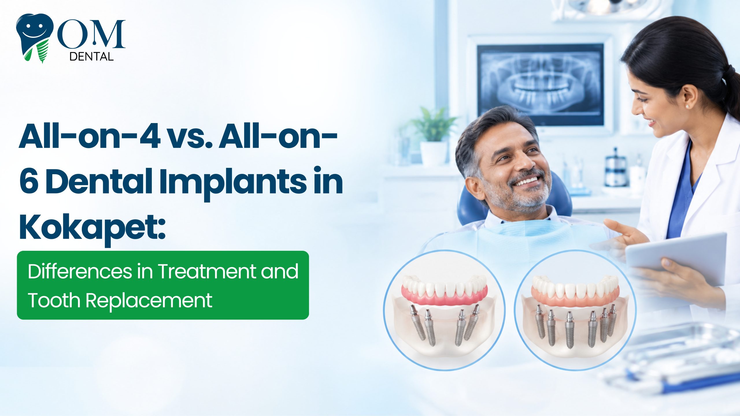 All-on-4 vs. All-on-6 Dental Implants in Kokapet